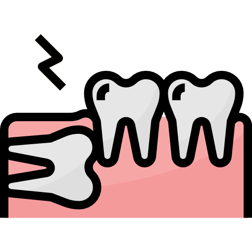 Cerrahi Diş Çekimi